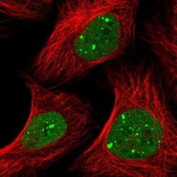 RNF2 Antibody, Novus Biologicals 0.1mL; Unlabeled:Antibodies, Polyclonal